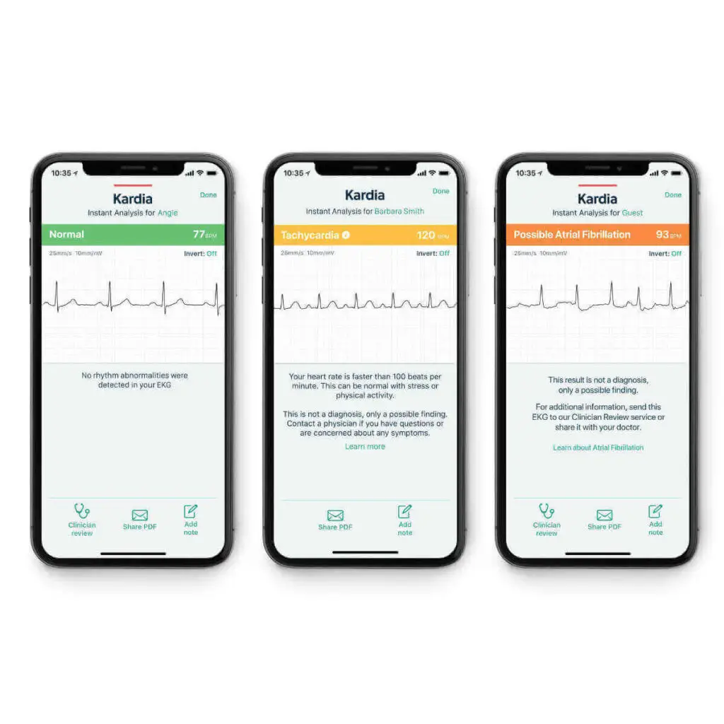 Close-up of KardiaMobile 6L device in use, demonstrating its compact design and ease of use for heart health monitoring