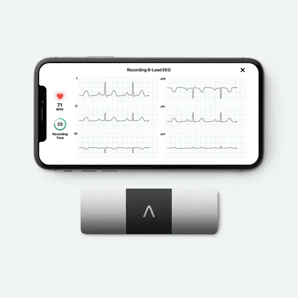 KardiaMobile 6L portable EKG device with a smartphone