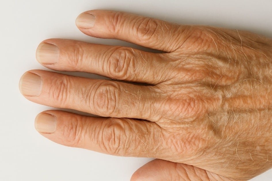 Close-up of aging hands, hair, and nails showing natural changes in skin, hair, and nails with age
